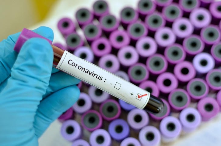 ¿Cuando estará disponible la vacuna contra el coronavirus?