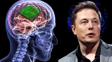 Los implantes cerebrales de Elon Musk son un éxito en personas con lesiones medulares