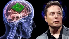 Los implantes cerebrales de Elon Musk son un éxito en personas con lesiones medulares